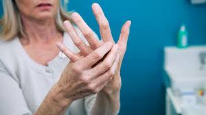 finger arthritis pain