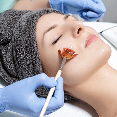 Revitalize Your Glow: The Magic of PCA Peel Treatments